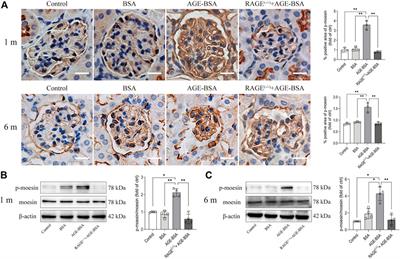 Advanced glycation endproducts mediate chronic kidney injury with characteristic patterns in different stages